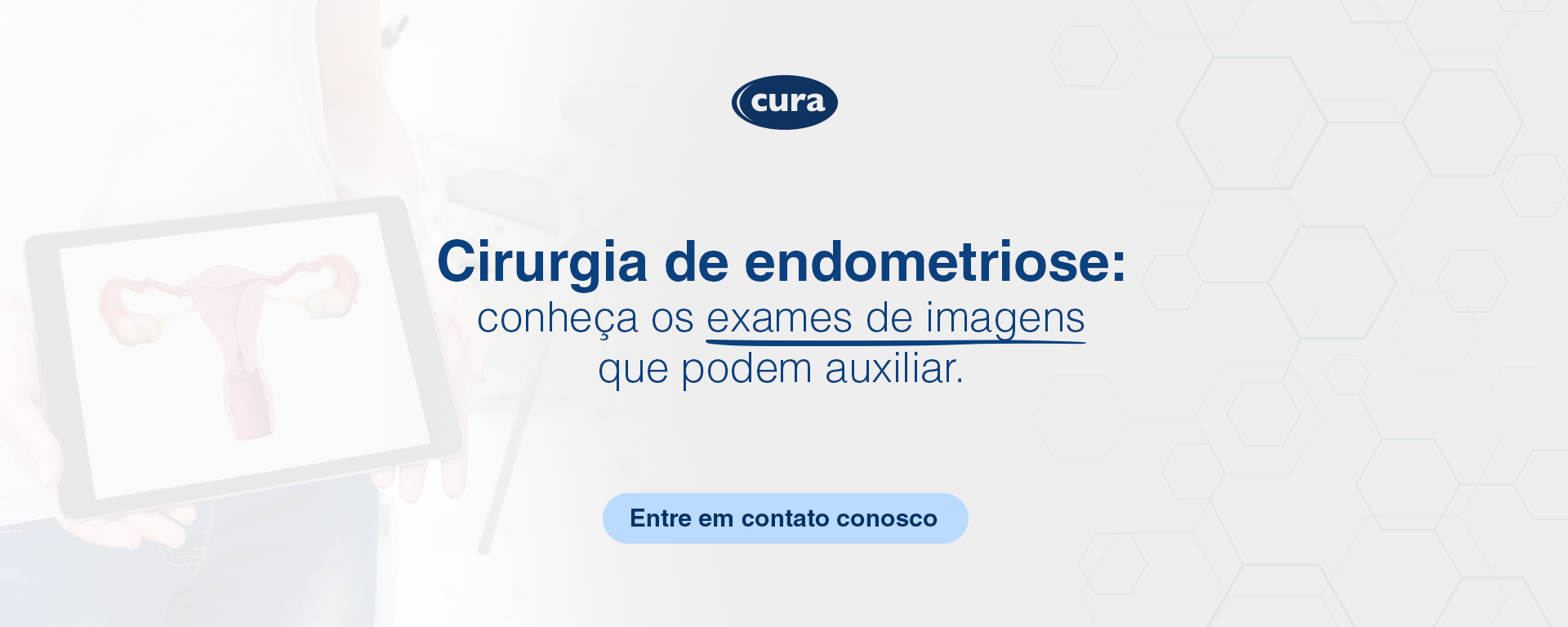 CURA_banner_SBE-Cirurgia-Endometriose